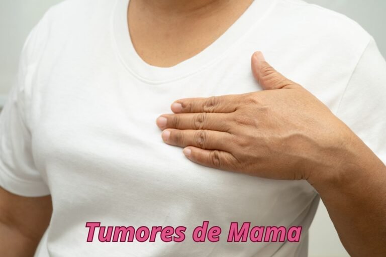 Tumores de Mama: Prevención, Detección y tratamiento